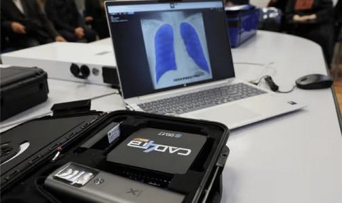 Туркменистан расширил диагностику туберкулеза с помощью ИИ